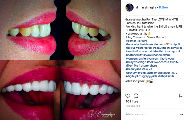 Instagram Marketing - Dr. Nassimagha